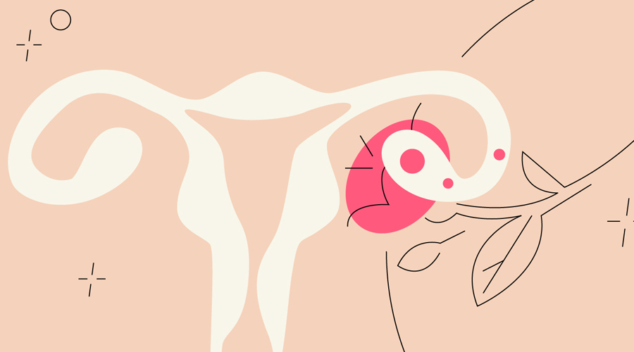 multiple ovulation